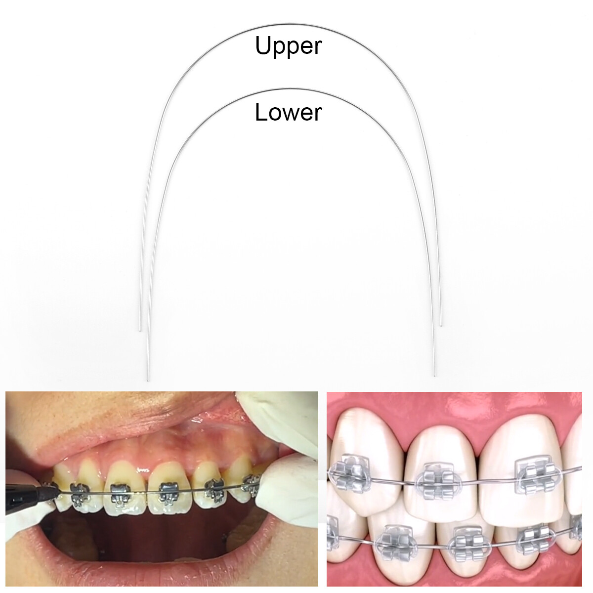 Dental Orthodontic Brackets Metal Braces/Super Elastic Niti Arch Wires Nature