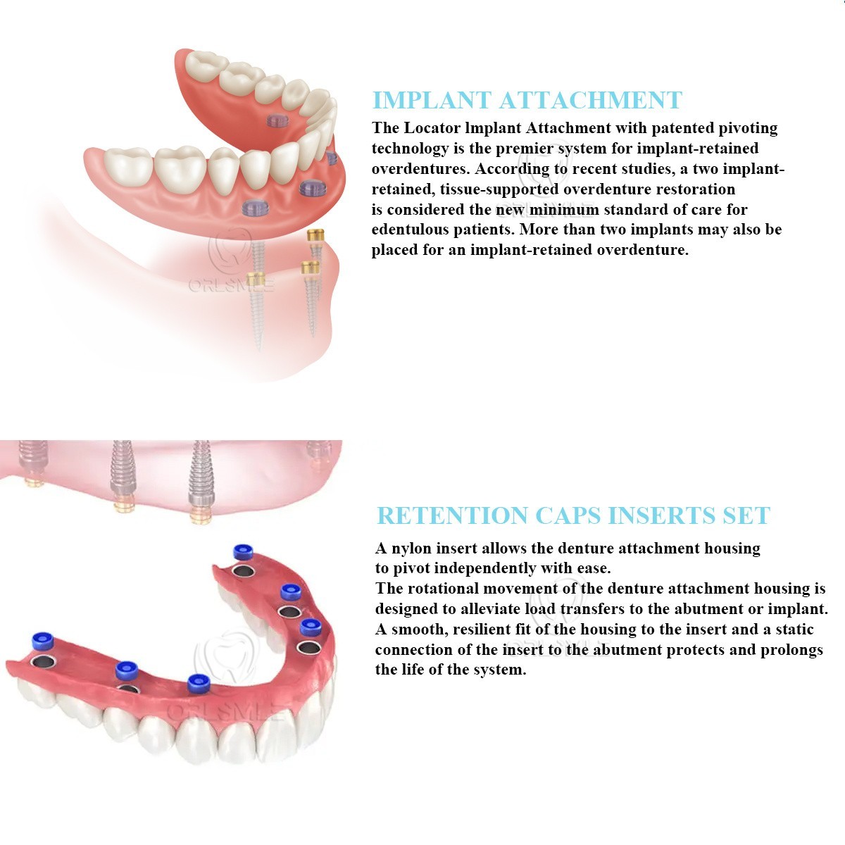 Locator abutment attachment full Set fit to Anthogyr（REG/PX） GH2-6mm